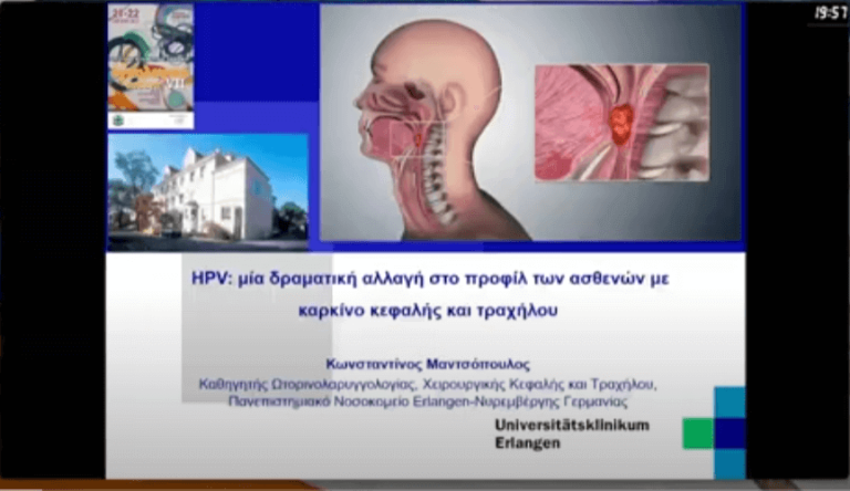 Ομιλία με θέμα: “HPV: μία δραματική αλλαγή στο προφίλ των ασθενών με καρκίνο κεφαλής και τραχήλου”